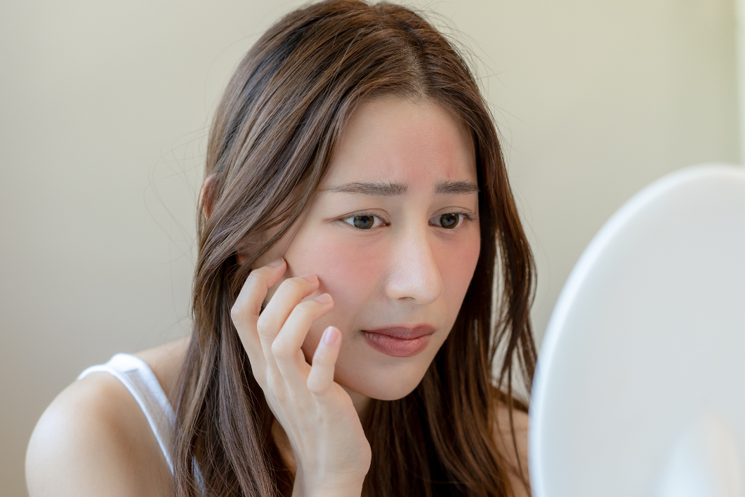 肌膚好敏感！敏感肌可以改善嗎？